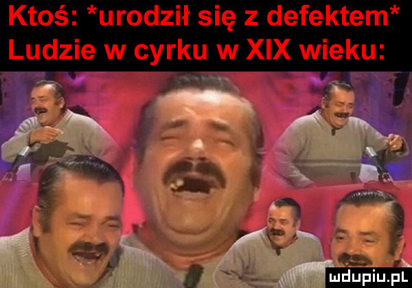 ktoś urodził się z defektem ludzie w cyrku w xix wieku