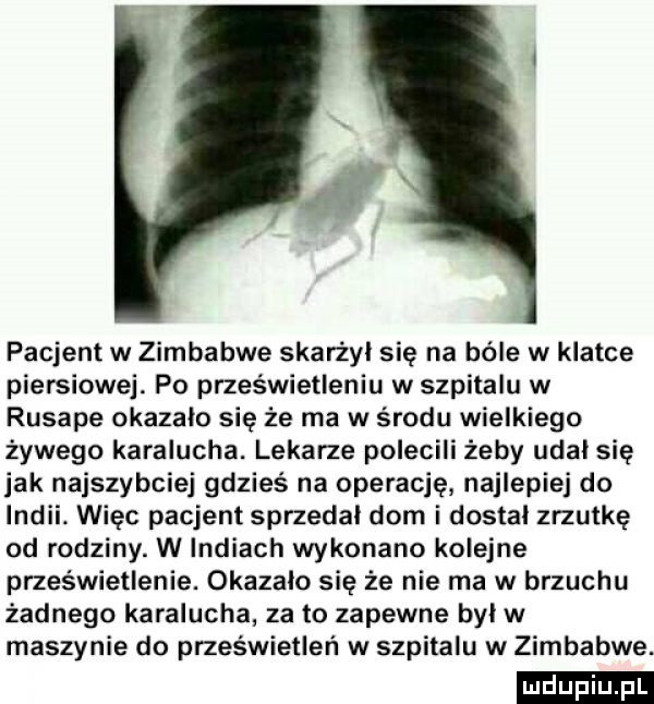 pacjent w zimbabwe skarżył się na bóle w klatce piersiowej. po prześwietleniu w szpitalu w rusape okazało się że ma w środu wielkiego żywego karalucha. lekarze polecili żeby udał się jak najszybciej gdzieś na operację najlepiej do indii. więc pacjent sprzedal dom i dostal zrzutkę od rodziny. w indiach wykonano kolejne prześwietlenie. okazalo się że nie ma w brzuchu żadnego karalucha za to zapewne byl w maszynie do prześwietleń w szpitalu w zimbabwe. ludu iu. l