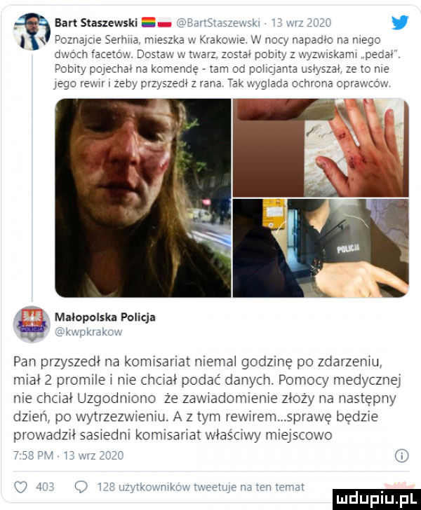 am staszewski zme w pozwem semka mieszka w kvakmwe w nocy napamo na wage dwoch facetów doszav. w twarz zbita pimy z wyzyskam pecha domy pojechm na komendę tam od pohganta mysza ze my me jego rew zeby przyszem z vana akwygnada uzmqna opraw cew malopolska policja w kuku pan przyszedł na kormsariat niemiał godzinę po zdarnemu miał   promile nie hdał podać danych. pomocy medycznej nie chciał uzgodniono ze zawwadomiem e złoży na następny dzień po wytrzezwieniu. a złym rewirem. sprawę będzie prowadzał saswedni komisanat właściwy miejscowo    a c  r   brimmm mw uff m ęn