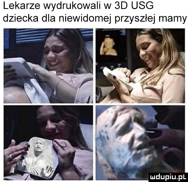 lekarze wydrukowali w  d usg dziecka dla niewidomej przyszłej mamy