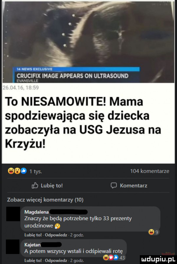 c le image appears on ultrasound to niesamowite mama spodziewająca się dziecka zobaczyła na usg jezusa na krzyżu    f uńchvirerc uh lulnętov c komontavz zobacz wnęcą komentarzy    magdalena znaczy że będą potrzebne tylko    prezenty urodzinowe lubx tal udpowmdz e   kajetan a potem wszyscy wstali i oas piewali rotę     lubm m odpowiedz