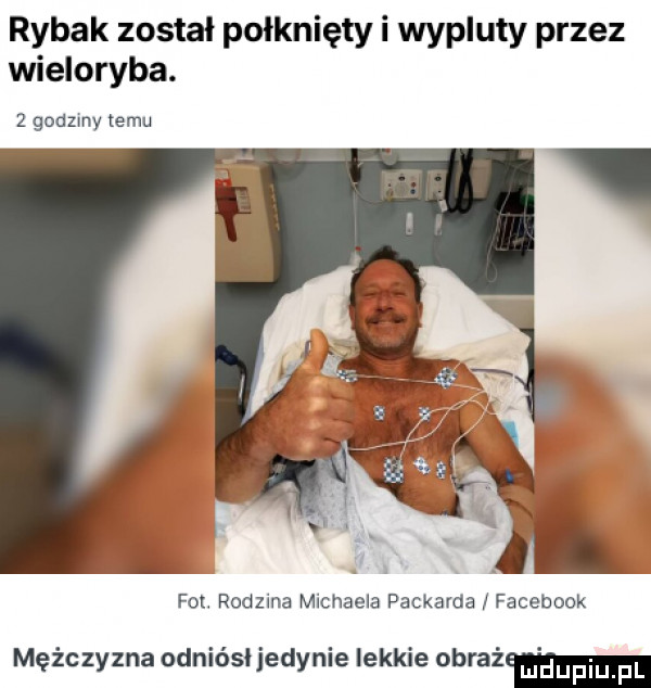 rybak został połknięty i wypluty przez wieloryba.   godzmy temu fot. rodzina michaela packarda facebook mężczyzna odniósł jedynie lekkie obmaż