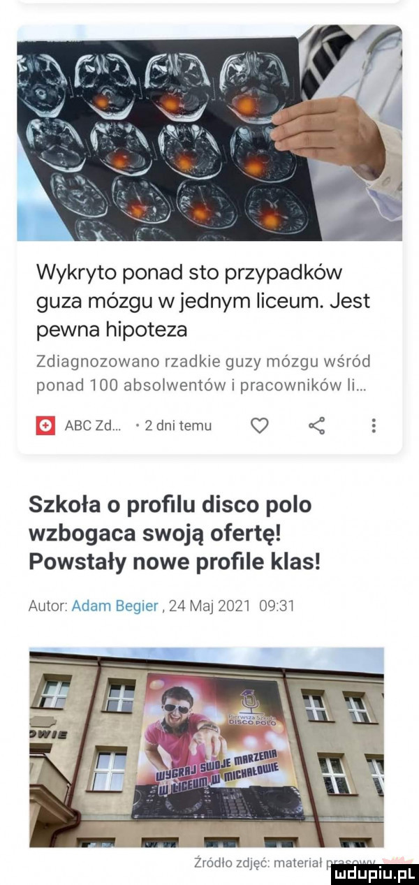 wykryto ponad sto przypadków guza mózgu wrednym liceum. jest pewna hipoteza zdiagnozowano rzadkie guzy mózgu wśród ponad     absolwentów i pracowmko w. abc zd. zdanemu   szkoła o profilu disco polo wzbogaca swoją ofertę powstały nowe proﬁle klas autor adam begler    ma            mmo we mama w