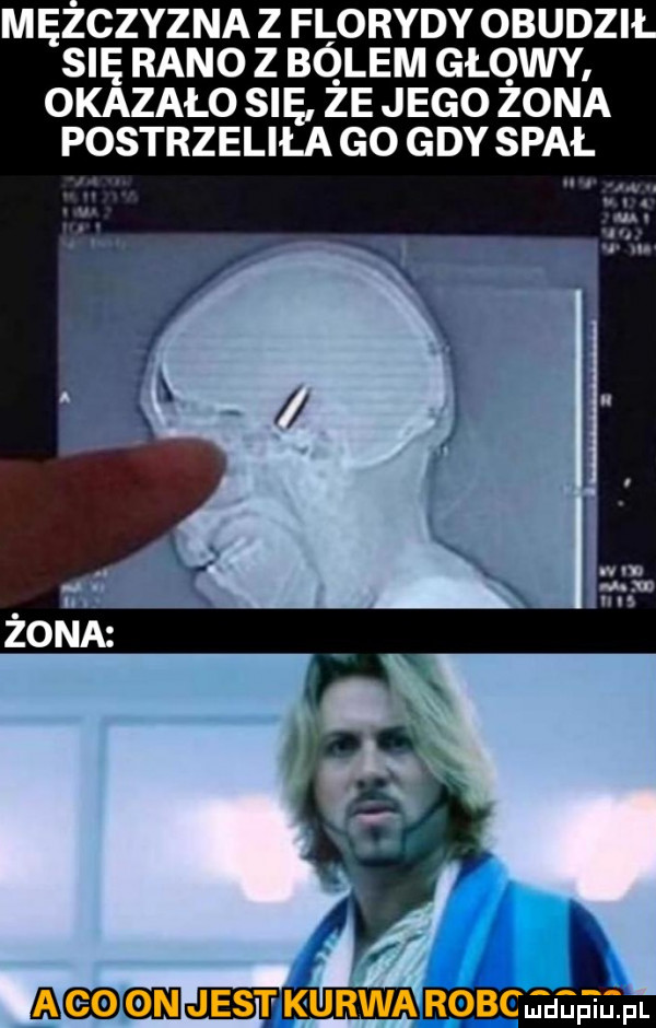 mężczyzna z florydy obudzi su rano z bó lem głowy okazalo sna ze jego zona postrzeliła go gdy spał