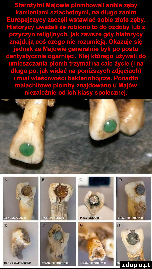 starożytni majowie plombowali sobie zęby kamieniami szlachetnymi na długo zanim europejczycy zaczeli wstawiać sobie złote zęby. historycy uważali że robiono to do ozdoby lub z przyczyn religijnych jak zawsze gdy historycy znajdują coś czego nie rozumieją. okazuje się jednak że majowie generalnie byli po postu dentystycznie ogarnięci. klej którego używali do umieszczania plomb trzymal na cale życie i na długo po jak widać na poniższych zdjęciach i miał właściwości bakteriobójcze. ponadto malachitowe plomby znajdowano u majów niezależnie od ich klasy społecznej