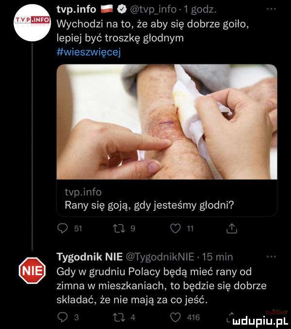 tvp info o tvp info   godz. wychodzi na to. że aby się dobrze goiło lepiej być troszkę głodnym wieszwięcej tvp info rany się goją. gdy jesteśmy głodni q    o   u h ili tygodnik nie tygodniknie   min gdy w grudniu polacy będą mieć rany od zimna w mieszkaniach to będzie się dobrze składać że nie mają za co jeść. q   u     lal u lu liu il
