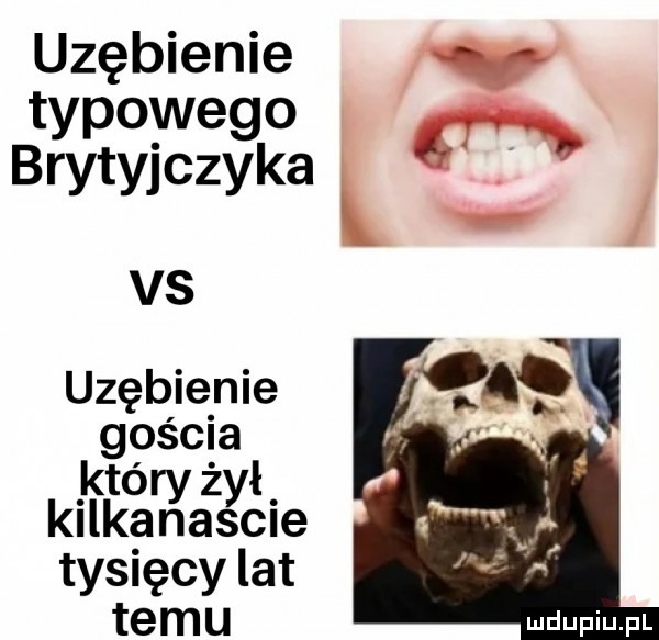 uzębienie typowego brytyjczyka vs uzębienie kgościał tó ż kilkarrxilagcie tysięcy lat temu