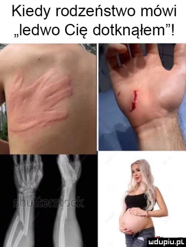 kiedy rodzeństwo mówi ledwo cię dotknąłem