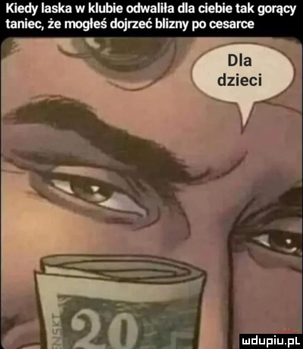 kiedy laska w klubie odwaliła dla ciebie tak gorący taniec że mogłeś dojrzeć blizny po oesaree