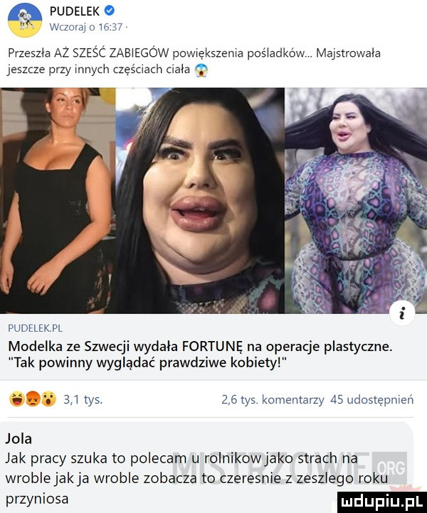 pudelek wazom o mn przeszła az sześć zabiegów powększema pośladków maptrowala jeszcze przy mnich częśoach lala vudłlek pl modelka ze szwecji wydala fortunę na operacje plastyczne. tak powinny wyglądać prawdziwe kobiety i     tys    ty  komentarzy as udostepmen jola jak pracy szuka to polecam u rolnikowjako strach na wroblejakja wroble zobacza to czeresnie z zeszlego roku