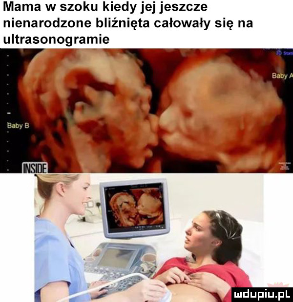 mama w szoku kiedy jej jeszcze nienarodzone bliźnięta całowały się na ultrasonografie