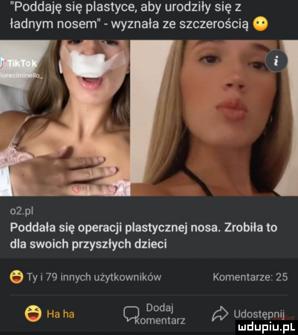 poddaję się plastyce aby urodziły się z ładnym nosem wyznała ze szczerością    p poddala się operacji plastycznej nosa. zrobiła to dla swoich przyszłych dzieci xf ty i    innych użytkowników komentarze    yﬁx dodaj omentarz udostępnij
