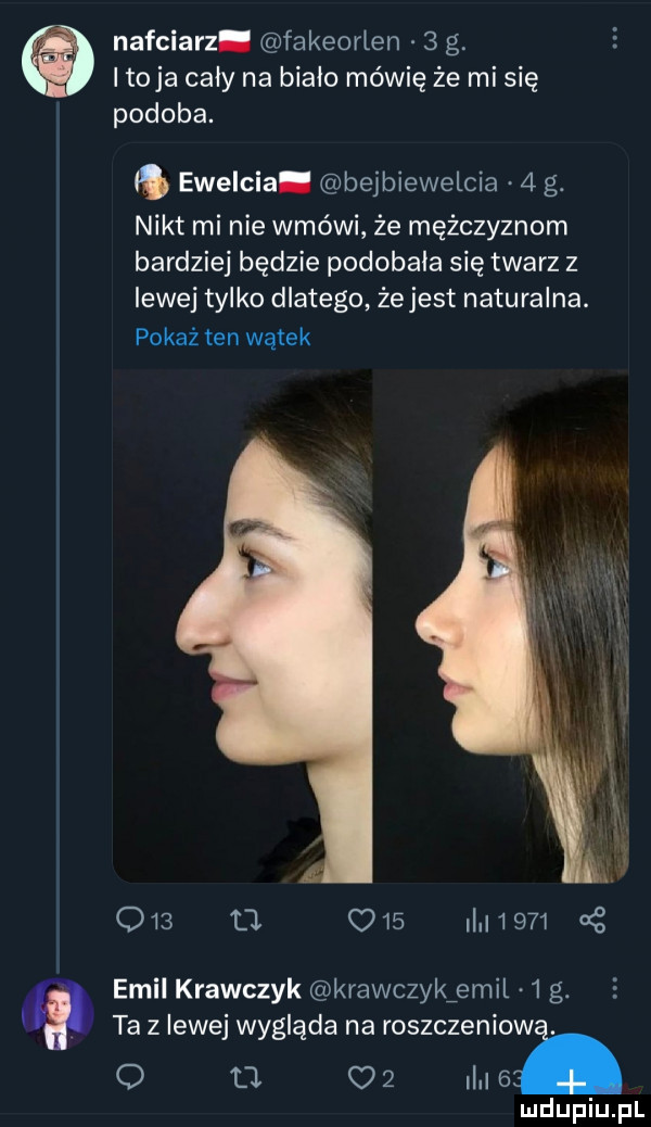 nafciarz fakeorlen   g. toja cały na bialo mówię że mi się podoba.  . ewelcia bejbiewelcia   g. nikt minie wmówi źe mężczyznom bardziej będzie podobala się twarz z lewej tylko dlatego że jest naturalna. pokaż ten wątek o    d. o    i d     g emil krawczyk krawczykźemil   g. ta z lewej wygląda na roszczenlow. o u    m e