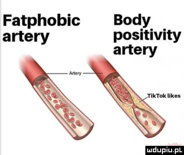 fatphobic body aftery positivity