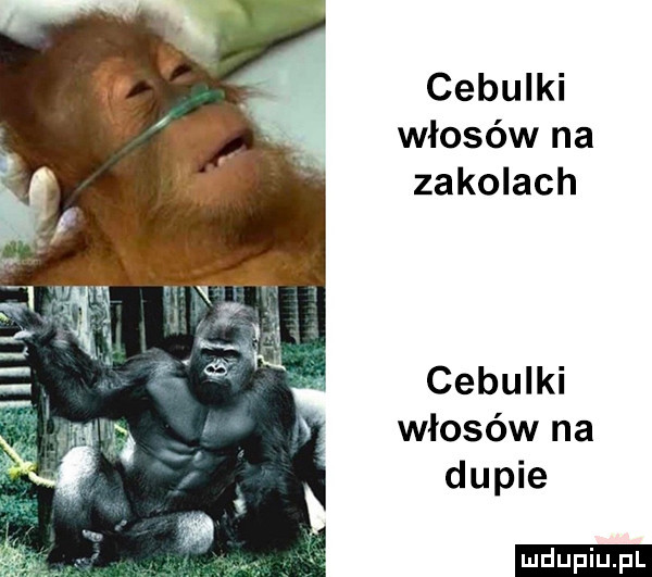 cebulki włosów na zakolach cebulki włosów na dupie ludu iu. l