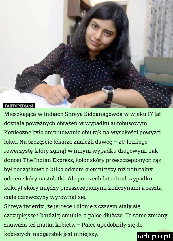 rmmpeuupl mieszkająca w indiach shreka siddanagowda w wieku    lat doznala powaznych obrazeri w wypadku autobusowym. konieczne bylo amputowanie obu rąk na wysokości powyzej lokat. na szczęście lekarze znależlr dawcę    letniego rowerzystę który zginal w innym wypadku drogowym. jak donosi tee indian express kolor skóry przeszczepionych rąk byl poczatkowo o kilka odcieni ciemnie say niz naturalny odcień skóry nastolatki. ale po trzech latach od wypadku koloryt skóry między przeszczepionymt kończynami a reszta ciala dziewczyny wyrówna się. shreka twierdzi ze je ręce i dlonie z czasem staly się szczuplejsze bardzie smukle a palce dluzsze. te same zmiany zauwaza tez matka kobiety. palce upodobmly się do kobiecych nadgarstek jest mniejszy