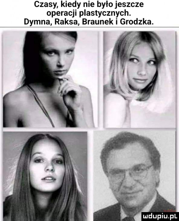 czasy kiedy nie było jeszcze operacji plastycznych. dymna raksa braunek i grodzka