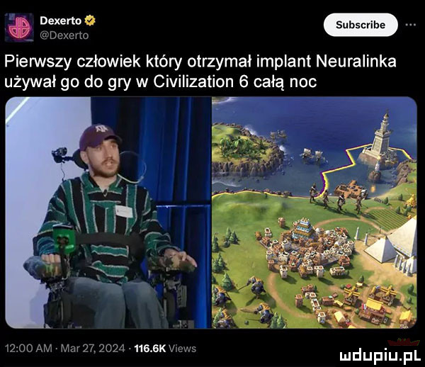 u dexerio pierwszy człowiek który otrzymał implant neuralinka używał go do gry w civilization   całą noc      am mev             k views