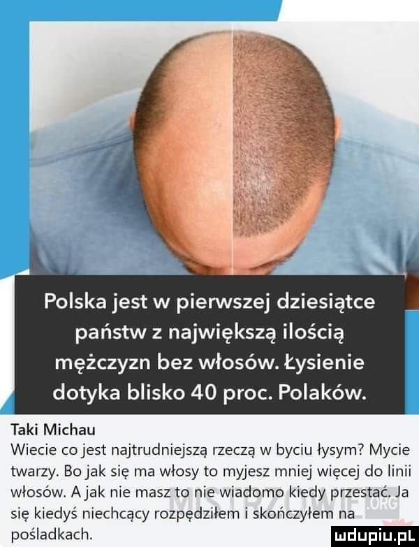 polska jest w pierwszej dziesiątce państw z największą ilością mężczyzn bez włosów. łysienie dotyka blisko    proc. polaków. taki michau wiecie ccljest najtrudniejszą rzeczą w byciu łysym mycie twarzy. bujak się ma włosy to myjesz mniej więcej do linii włosów abak nie masz to me wiadomo kiedy pnestać. ja się kiedyś niechcący rozpędziłem i skończyłem na pośladkach