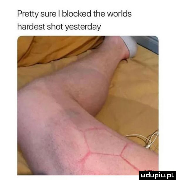 pratty sure i blocked tee worlds hardest shot yesterday