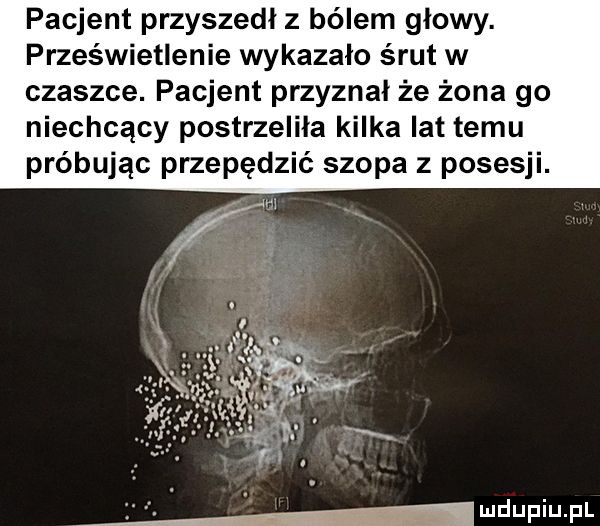 pacjent przyszedł z bólem głowy. prześwietlanie wykazało śrut w czaszce. pacjent przyznał że żona go niechcący postrzeliła kilka lat temu próbując przepędzić szopa z posesji