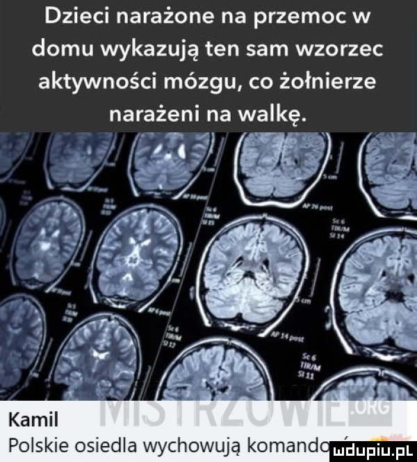 dzieci narażone na przemoc w domu wykazują ten sam wzorzec aktywności mózgu co żołnierze narażeni na walkę. polskie osiedla wychowują komand omufqul
