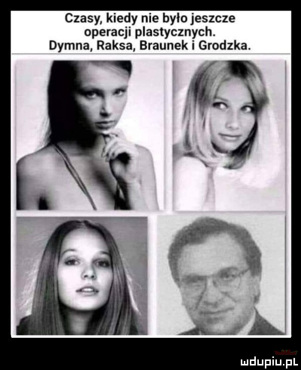 czasy kiedy nie było jeszcze operacji plastycznych. dymna raksa braunek i grodzka
