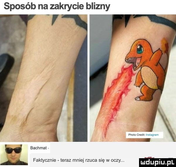 sposób na zakrycie blizny mmm mmm bachmal i. faktyczne teraz mniej rzuca się w oczy. lud upiu f