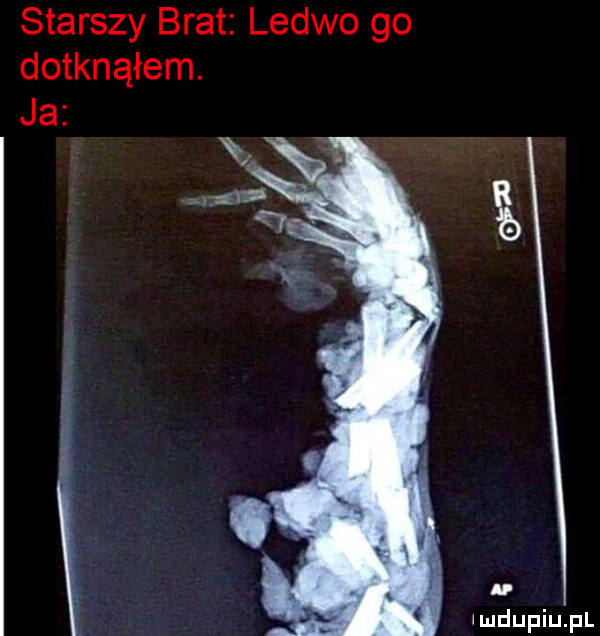 starszy brat ledwo go dotknąłem. ja