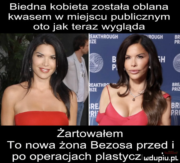 biedna kobieta została oblana kwasem w miejscu publicznym oto jak teraz wygląda żartowałem to nowa żona bezoka przed i po operacjach plastyczwmuup ibm