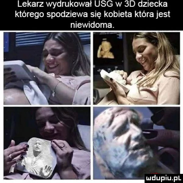 lekarz wydrukował usg w  d dziecka którego spodziewa się kobieta która jest niewidoma