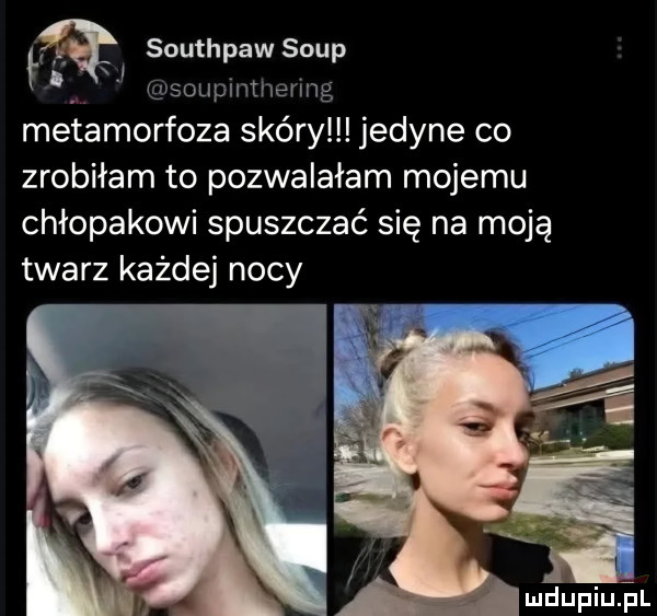 łą southpawsoup i j. ij sonpmtnermg metamorfoza skóry jedyne co zrobiłam to pozwalałam mojemu chłopakowi spuszczać się na moją twarz każdej nocy