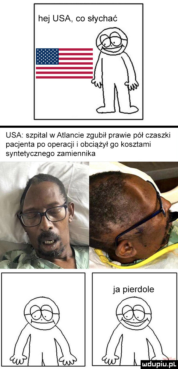 hej usa co słychać usa szpital w atlancie zgubił prawie pół czaszki pacjenta po operacji i obciążył go kosztami syntetycznego zamiennika   lż lt