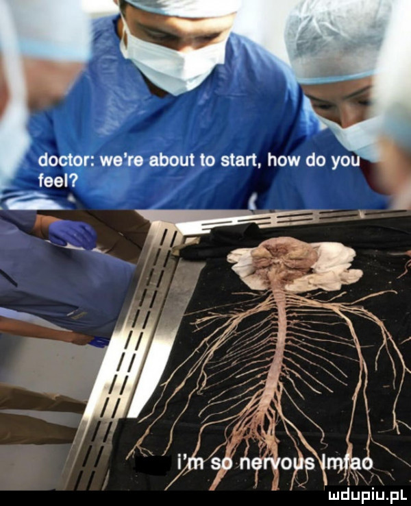 do r welt. abort to start. hiw do yo fell