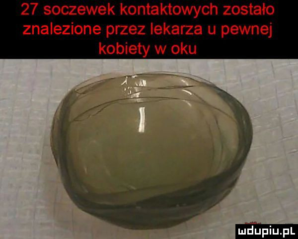 soczewek kontaktowych zostało znalezione przez lekarza u pewnej kobiety w oku
