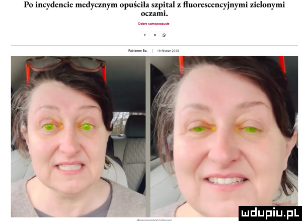 fo incydencie medycznym opuściła szpiul   ﬂuoresccncyjnymi ziclnnymi oczami