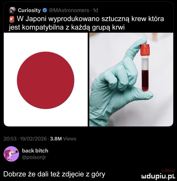 curiosiky o ś w japoki wyprodukowano sztuczną krew która jest kompatybilna z każdą grupą krwi      m beck bitch dobrze że dali też zdjęcie z góry