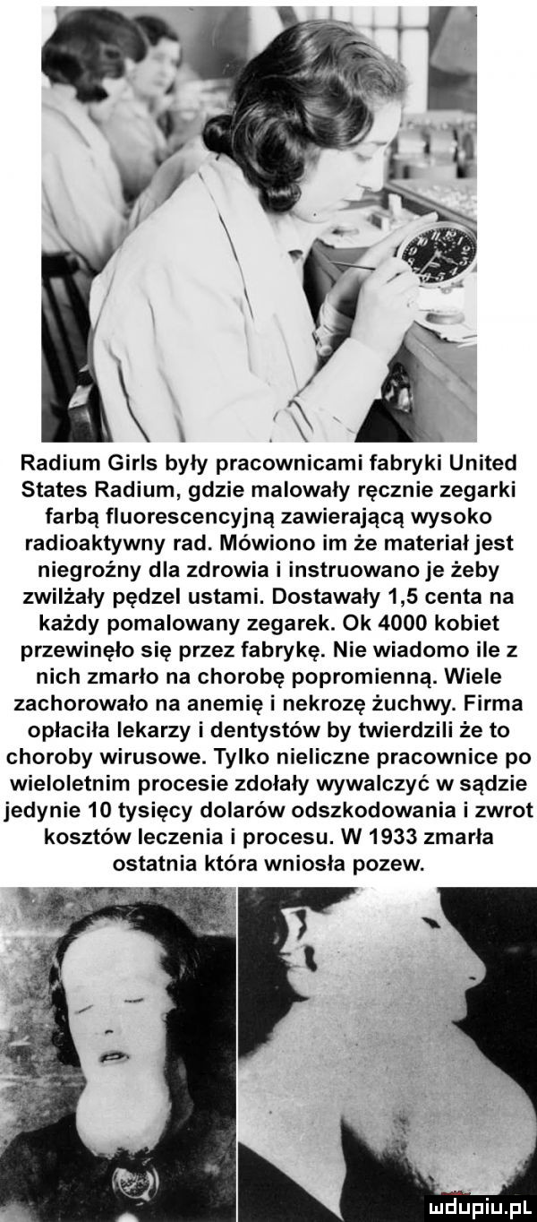 radium girls były pracownicami fabryki united status radium gdzie malowały ręcznie zegarki farbą fluorescencyjna zawierającą wysoko radioaktywny rad. mówiono im że materiałjest niegroźny dla zdrowia i instruowano je żeby zwilżały pędzel ustami. dostawały     centa na każdy pomalowany zegarek. ok      kobiet przewinęło się przez fabrykę. nie wiadomo ile z nich zmarło na chorobę popromienną. wiele zachorowało na anemię i nekrozę żuchwy. firma opłaciła lekarzy i dentystów by twierdzili że to choroby wirusowe. tylko nieliczne pracownice po wieloletnim procesie zdołały wywalczyć w sądzie jedynie    tysięcy dolarów odszkodowania i zwrot kosztów leczenia i procesu. w      zmarła ostatnia która wniosła pozew. mjupiupl