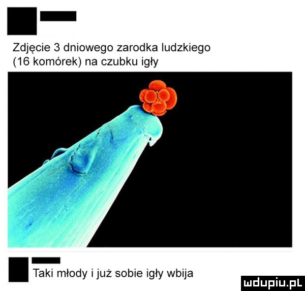 zdjęcie   dylowego zarodka ludzkiego    komórek na czubku igły tak młody iluż sobie igły wbija