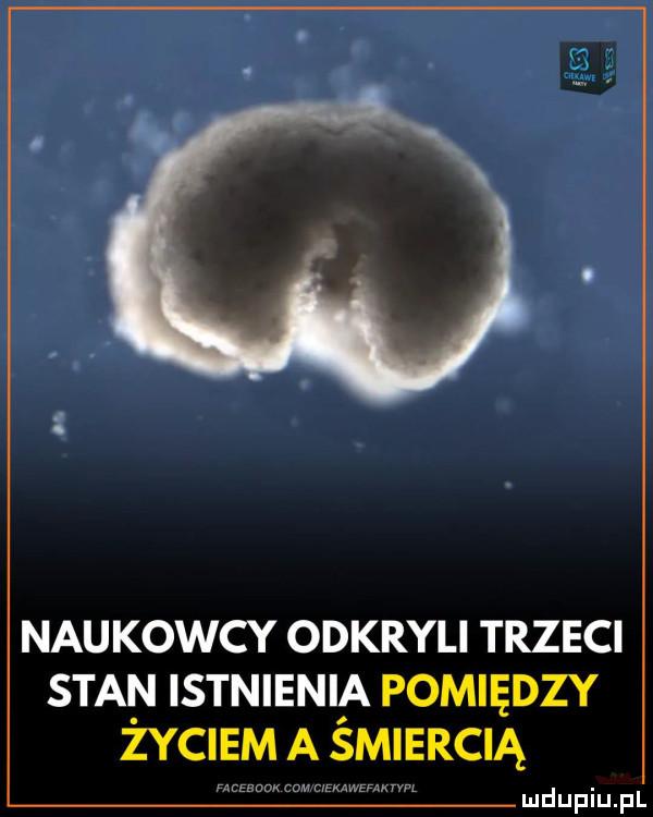 naukowcy odkryli trzeci stan istnienia pomiędzy życiem a śmiercią ludupiu. pl