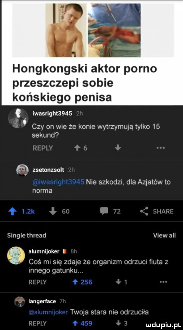 hongkongski aktor porno przeszczepi sobie końskiego penisa iwasrighl     r fr. czy on we ze kome wytrzymują tylko    sekund wba v w zsemnzsolt waanm was nie szkodzl dla azjatów to norma f zk i a a single thread view all alumnijoker coś ml sue zdaje ze organizm odrzucn fiuta z mnogo gatunku     iangerface m twoje stara me odrzucnla w o