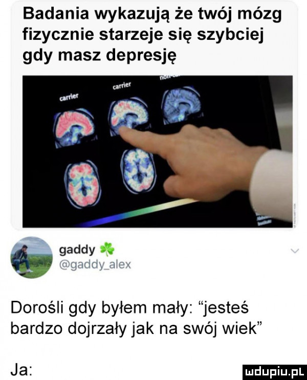 badania wykazują że twój mózg fizycznie starzeje się szybciej gdy masz depresję geddy v mam mm. dorośli gdy byłem mały jesteś bardzo dojrzały jak na swój wiek ja