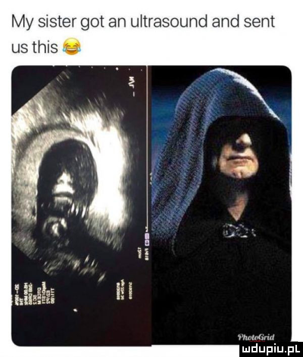 my sister got an ultrasound and sent us tais   in mad