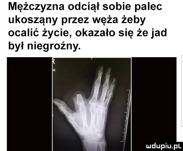 mężczyzna odciął sobie palec ukoszony przez węża żeby ocalić życie okazało się że jad był niegroźny