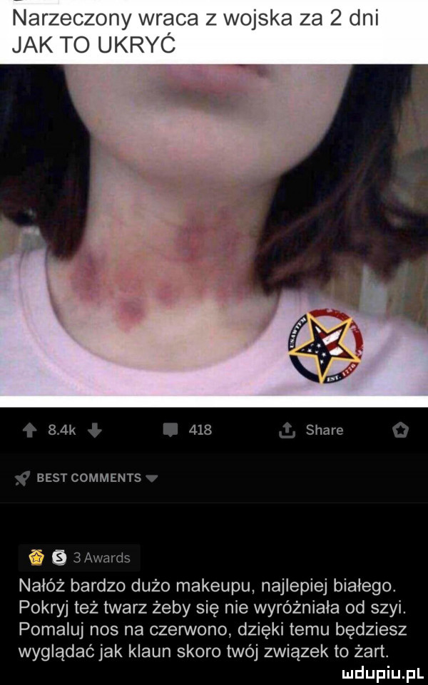narzeczony wraca z wojska za   dni jak to ukryc    k     stare best comments      awards nałóż bardzo dużo makeupu najlepiej białego. pokryj też twarz żeby się nie wyróżniała od szyi. pomaluj nos na czerwono dzięki temu będziesz wyglądać jak klaun skoro twój związek to żart
