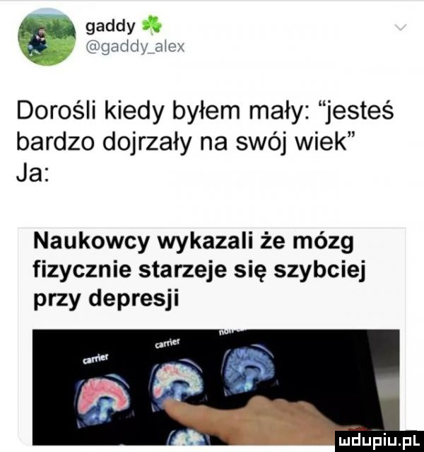 geddy   tgaddy alex dorośli kiedy byłem mały jesteś bardzo dojrzały na swój wiek ja naukowcy wykazali że mózg fizycznie starzeje się szybciej przy depresji maupiupl