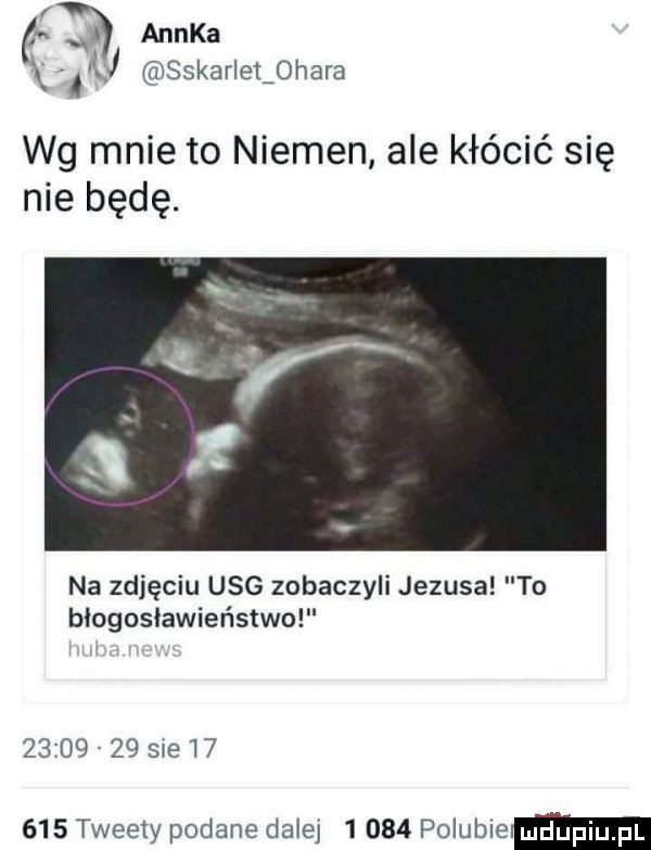 a anika ąhj szkarlet  hera wg mnie to niemen ale kłócić się nie będę. na zdjęciu usg zobaczyli jezusa to błogosławieństwo         sie        tweety podane dalej       polublem