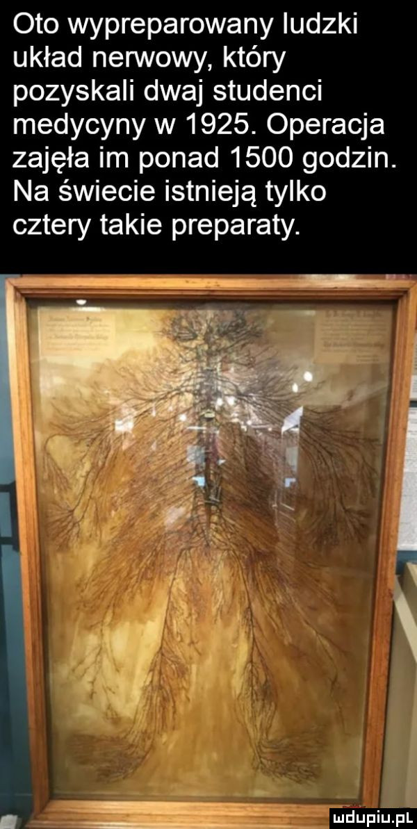 oto wypreparowany ludzki układ nerwowy który pozyskali dwaj studenci medycyny w     . operacja zajęła im ponad      godzin. na świecie istnieją tylko cztery takie preparaty. ii i. wdupiu p